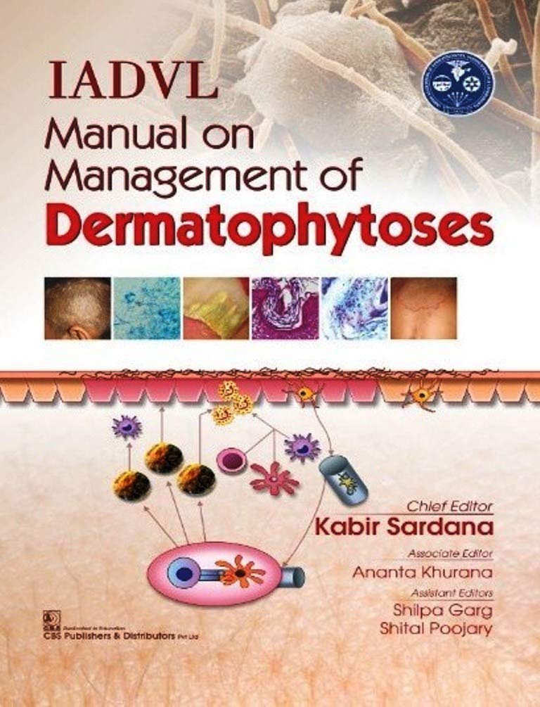 Iadvl Manual On Management Of Dermatophytoses (Hb)