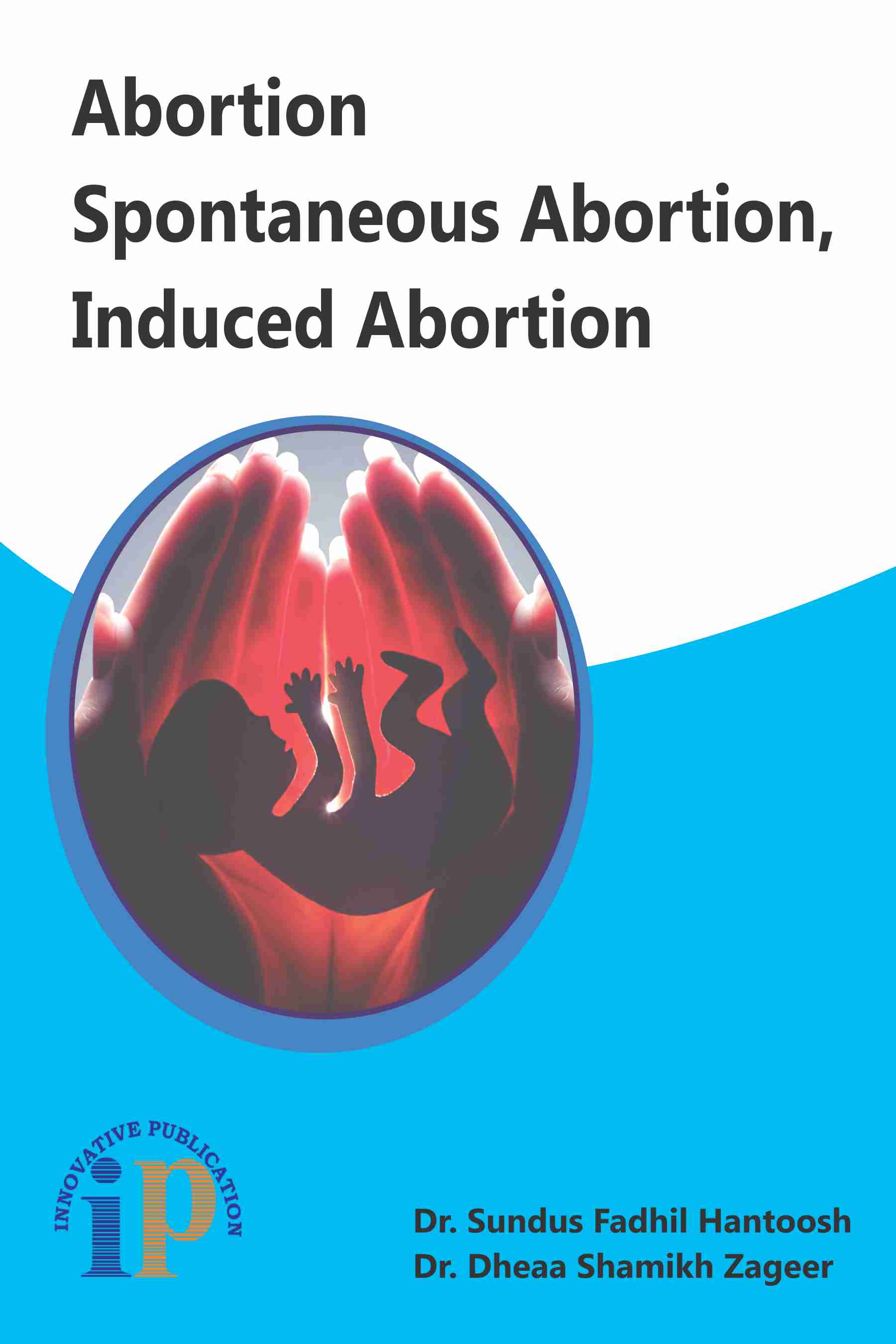 Abortion Spontaneous Abortion, Induced Abortion
