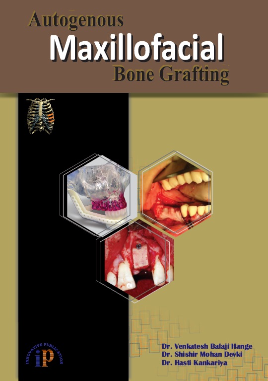 Autogenous Maxillofacial Bone Grafting