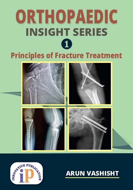 Orthopaedic Insight Series 1 : Principles Of Fracture Treatment