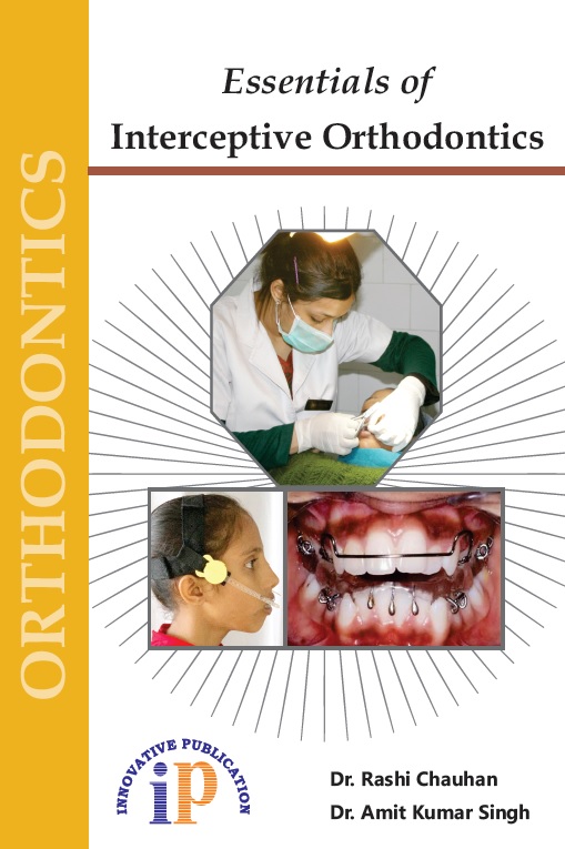 Essentials Of Interceptive Orthodontics
