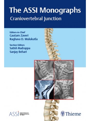The Assi Monographs: Craniovertebral Junction : 1/E