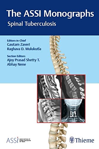 The Assi Monographs: Spinal Tuberculosis: 1/E