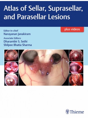 Atlas Of Sellar, Suprasellar And Parasellar Lesions
