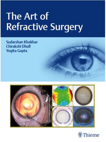Art Of Refractive Surgery: 1/E