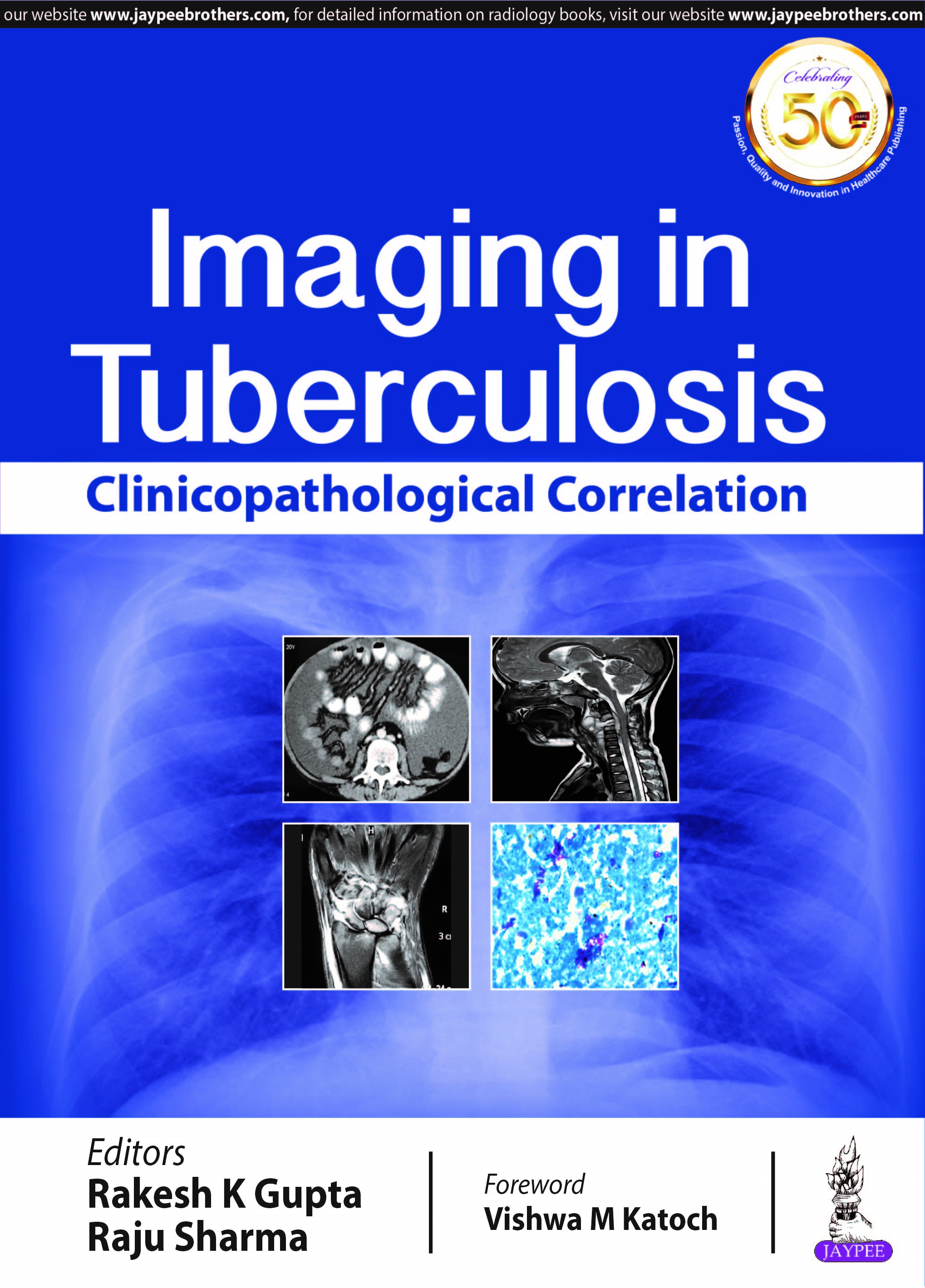 Imaging In Tuberculosis: Clinicopathological Correlation