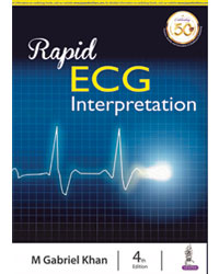 Rapid Ecg Interpretation