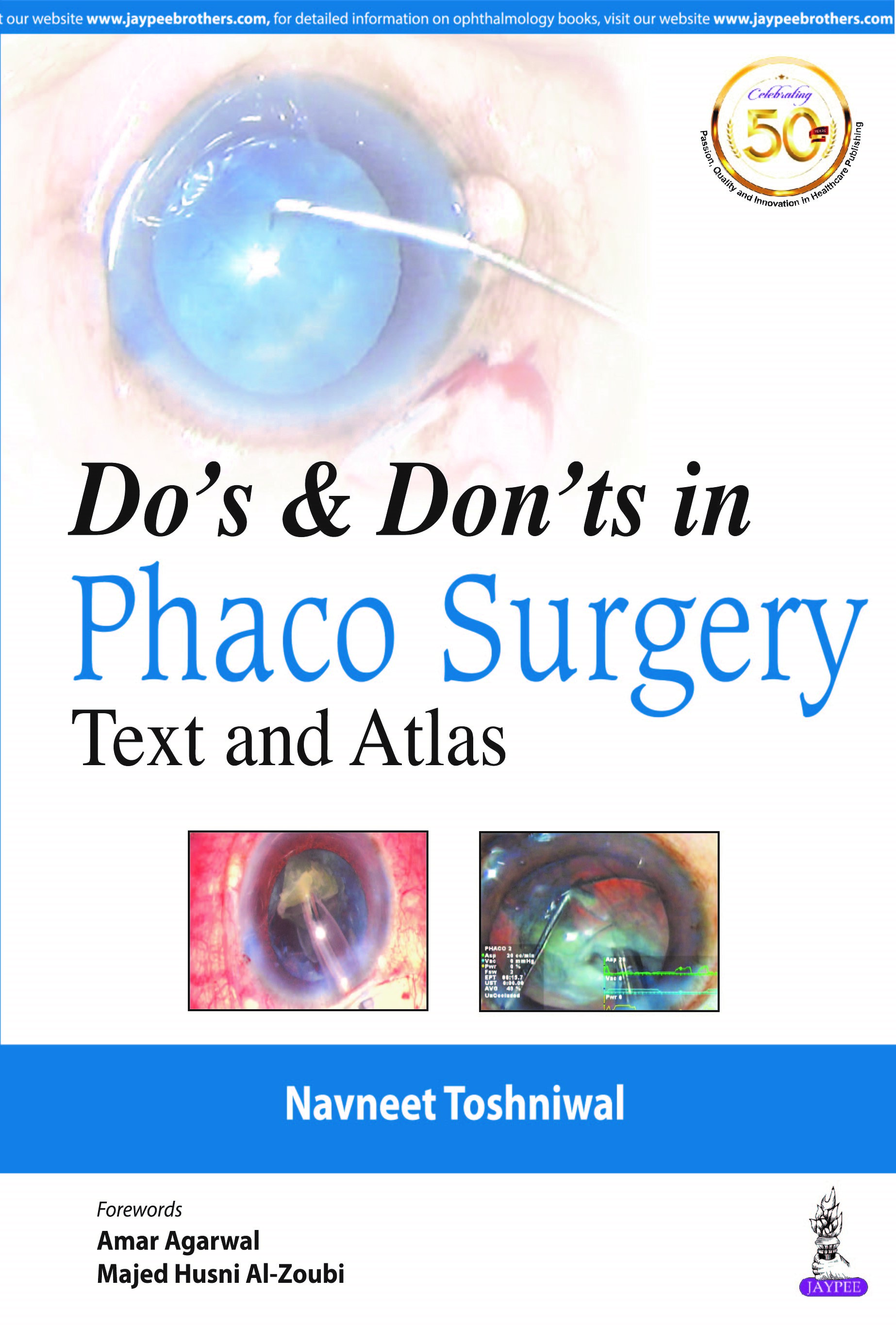 Do's & Don'ts In Phaco Surgery Text And Atlas