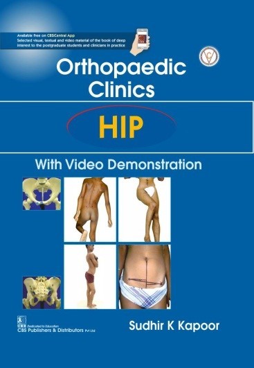 Orthopaedic Clinics Hip With Video Demonstration (Hb 2020)