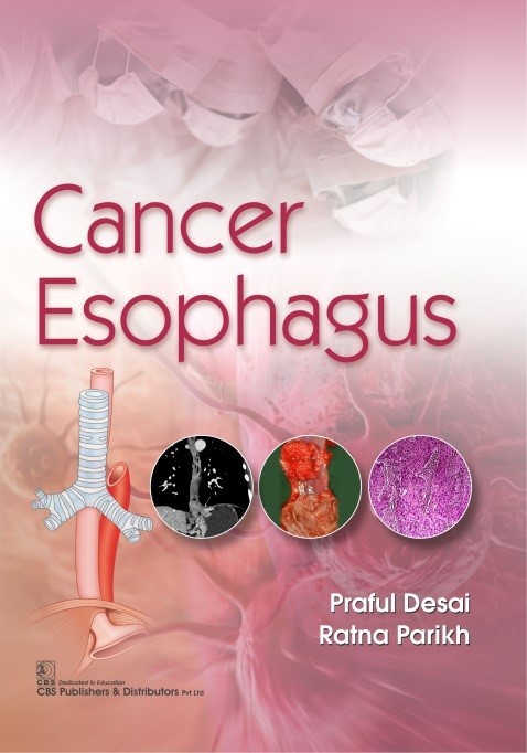 Cancer Esophagus (Pb 2020)