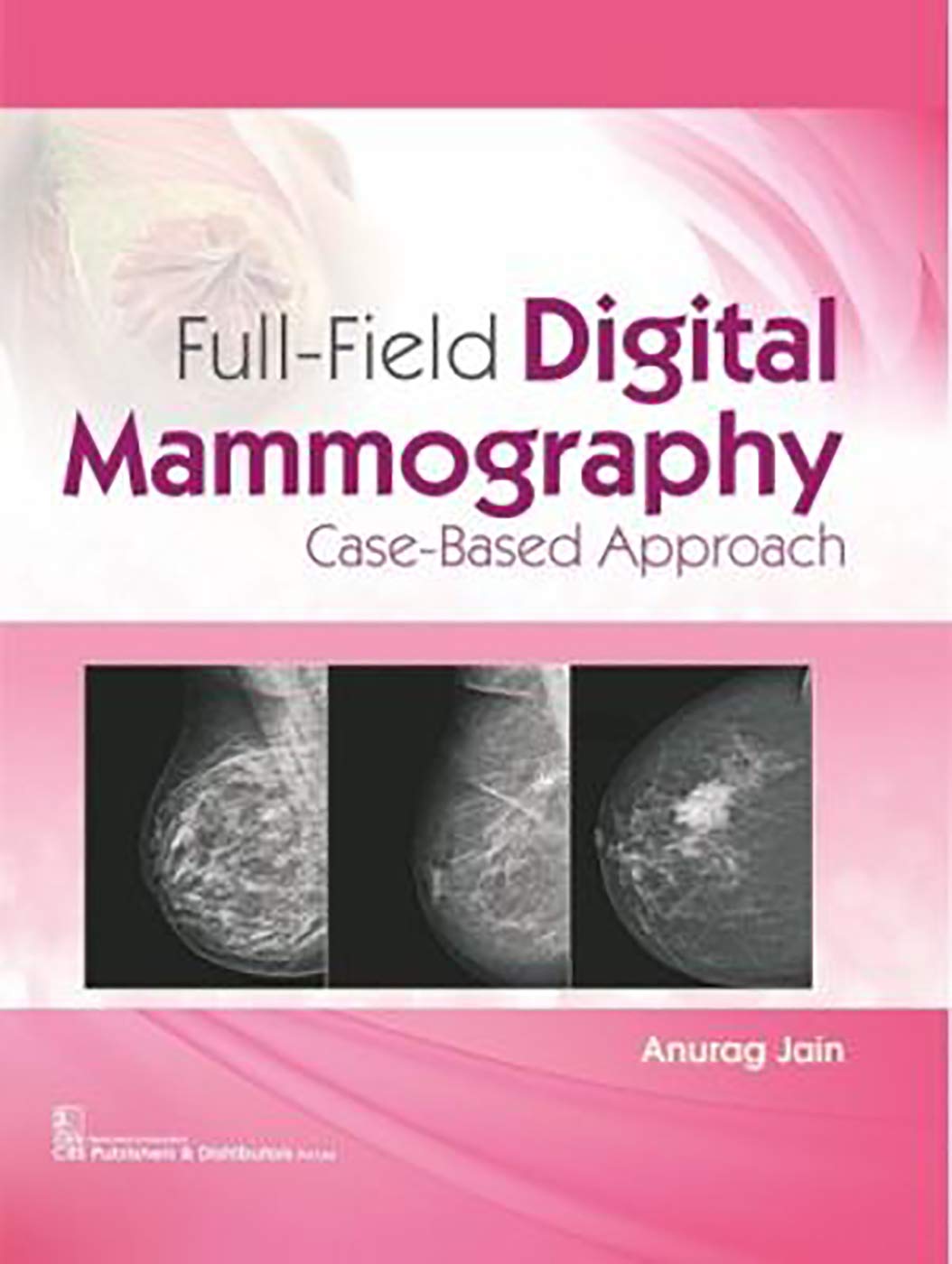 Full-Field Digital Mammography: Case-Based Approach (Hb)