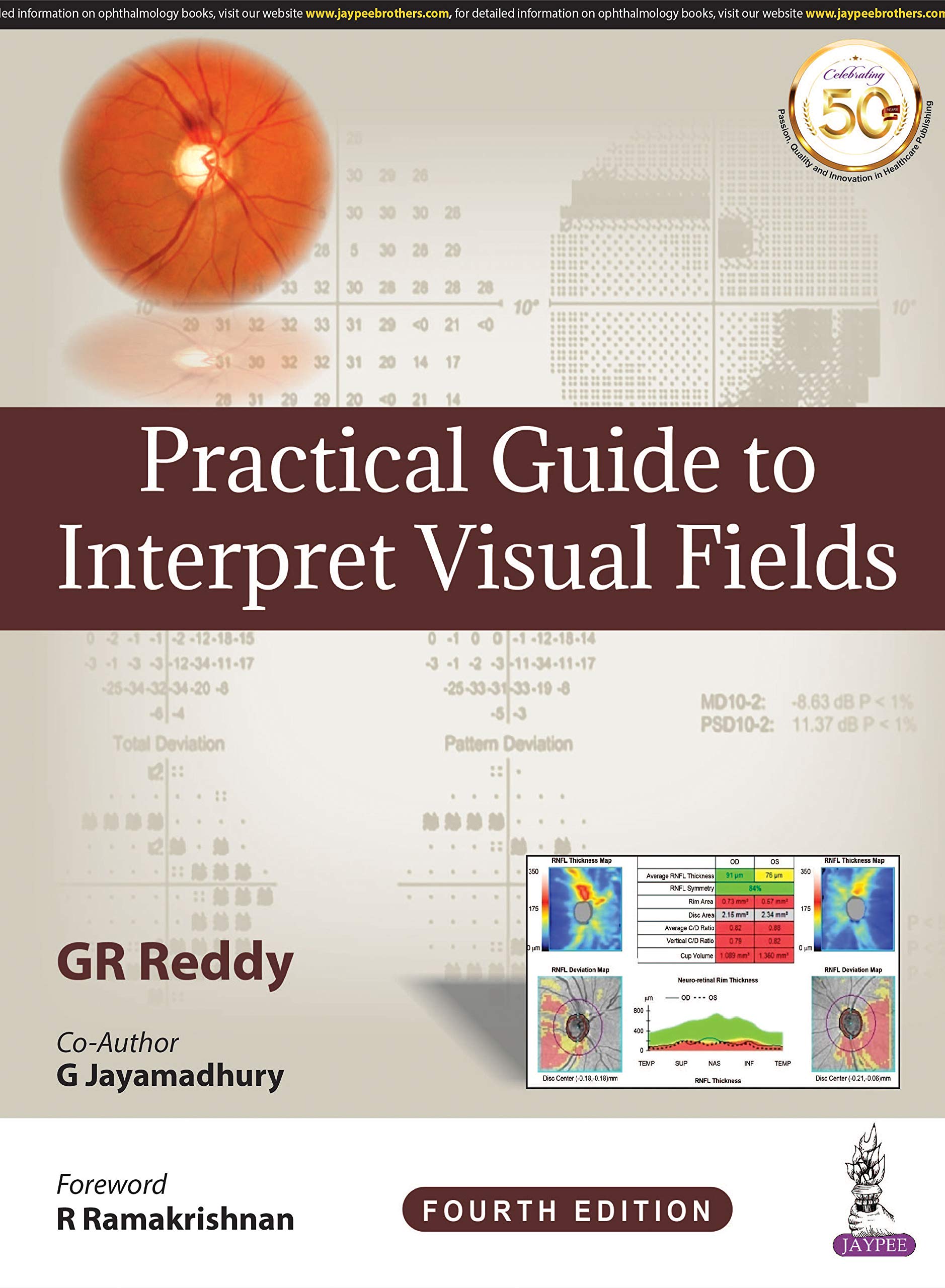 Practical Guide To Interpret Visual Fields
