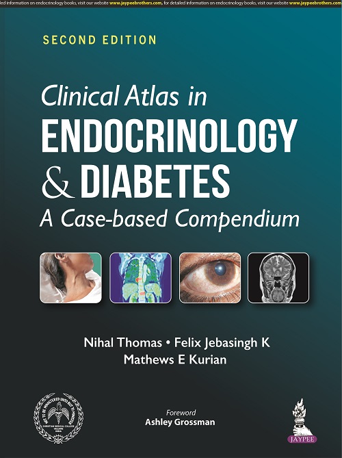 Clinical Atlas In Endocrinology & Diabetes: A Case-Based Compendium