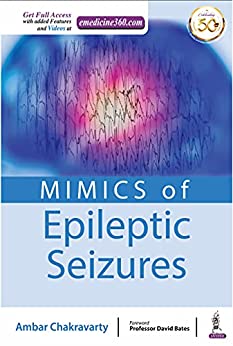 Mimics Of Epileptic Seizures
