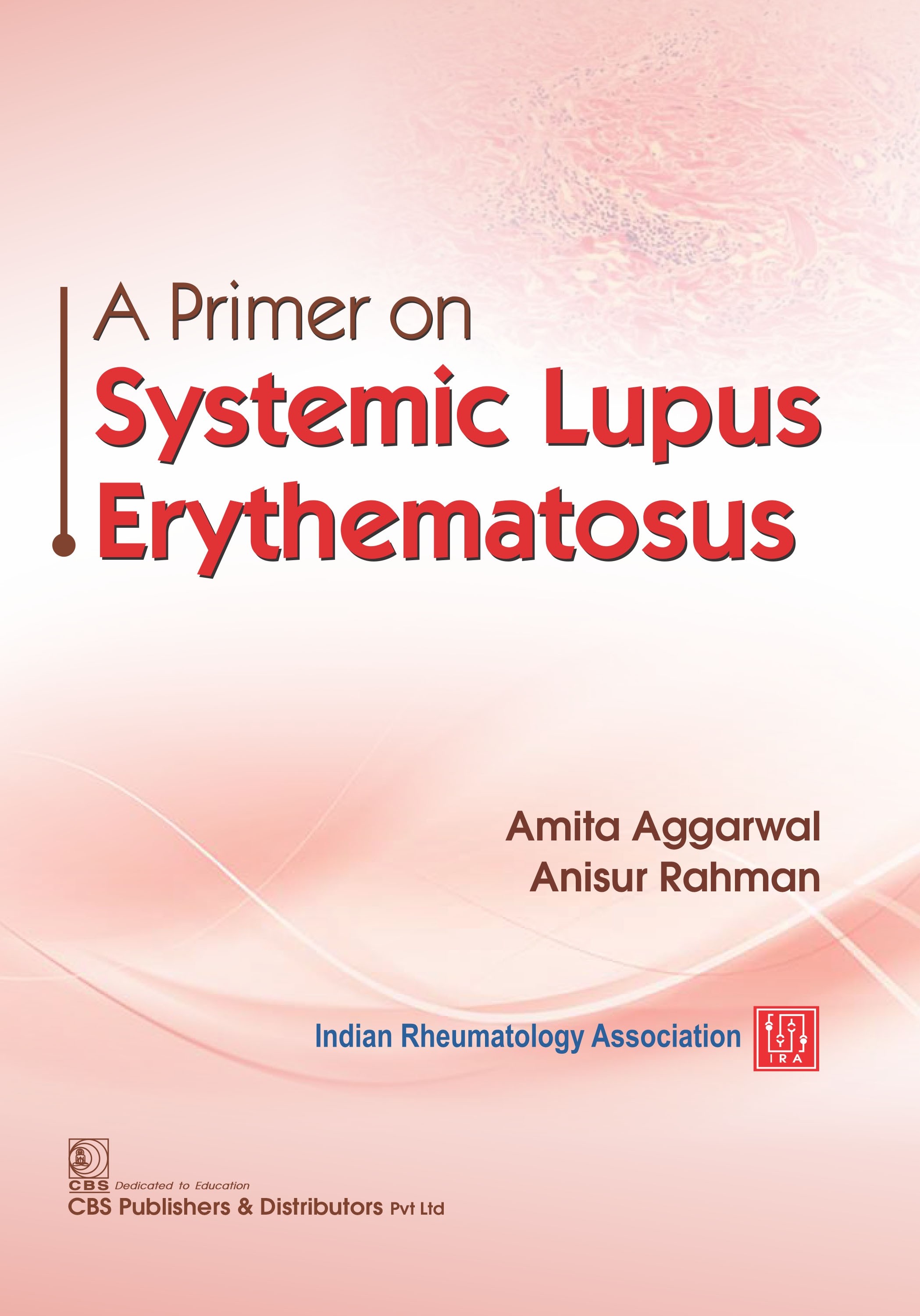 A Primer On Systemic Lupus Erythematosus (Pb 2021)