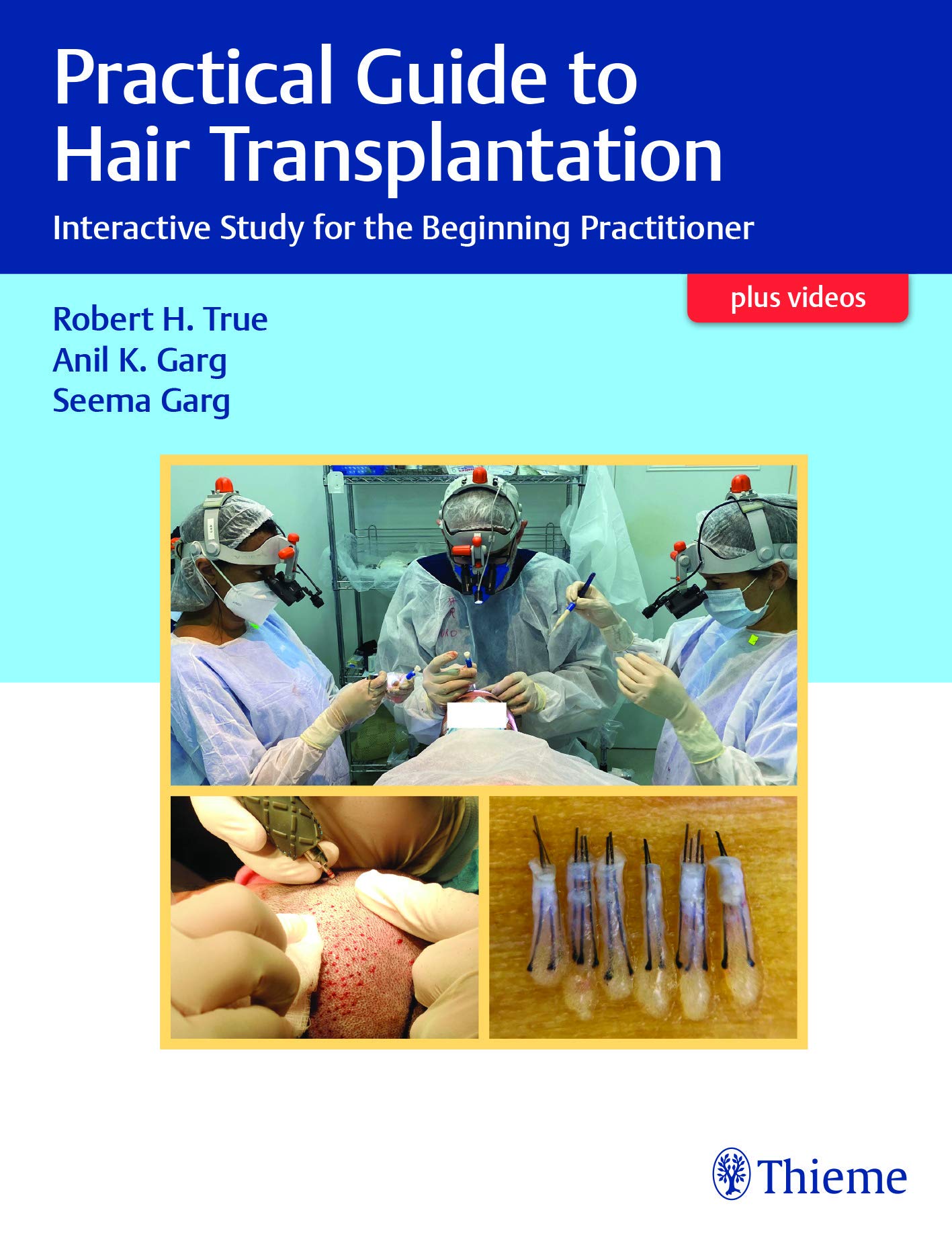 Practical Guide To Hair Transplantation