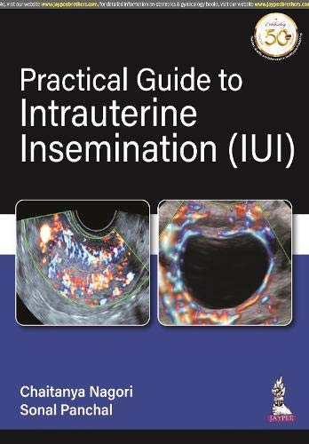 Practical Guide To Intrauterine Insemination (Iui)