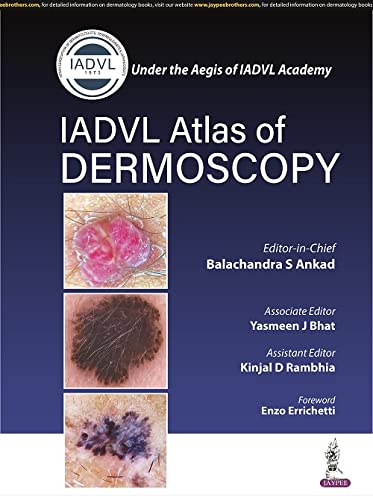 Iadvl Atlas Of Dermoscopy