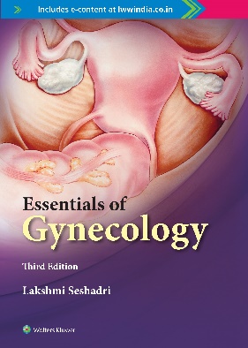 Essentials of Gynecology 3/e