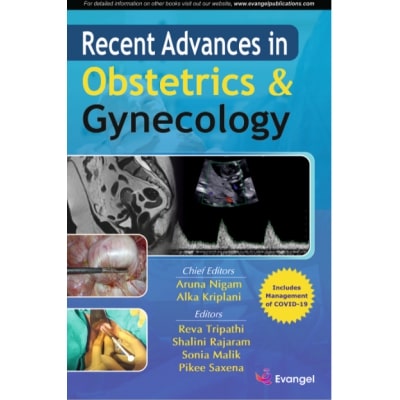 Recent Advances In Obstetrics & Gynecology 1St/2021