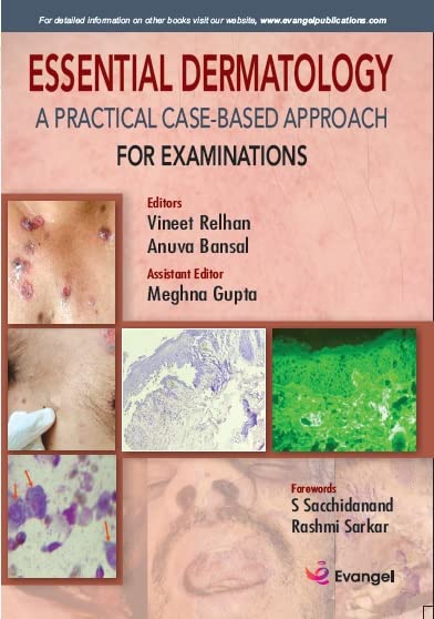 ESSENTIAL DERMATOLOGY A PRACTICAL CASE-BASED APPROACH FOR EXAMINATIONS