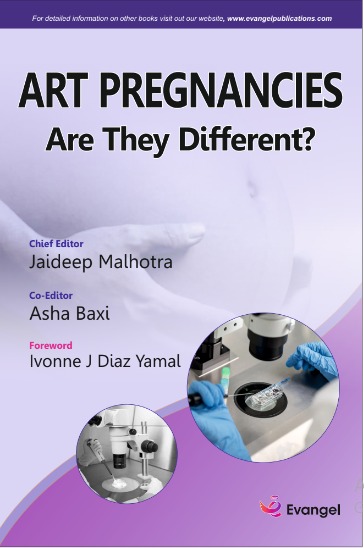 Art Pregnancies Are They Different?