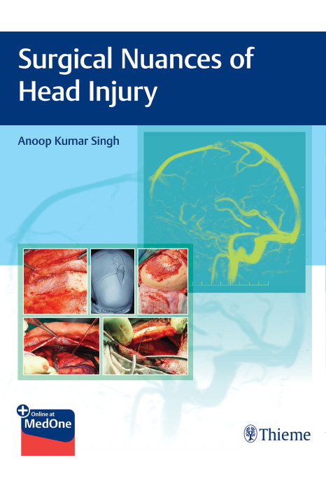 Surgical Nuances Of Head Injury 1st Ed.