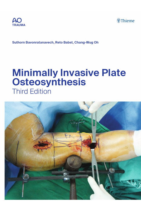 Minimally Invasive Plate Osteosynthesis 3/e