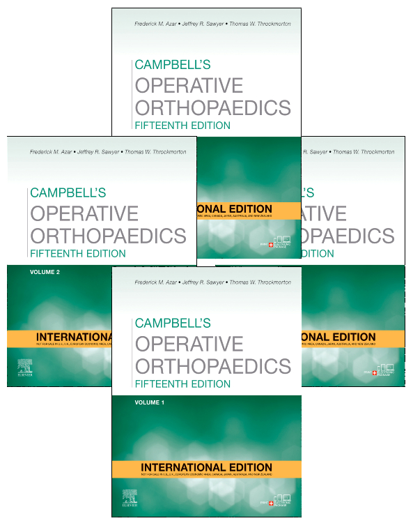 Campbell's Operative Orthopaedics -4 Vol Set