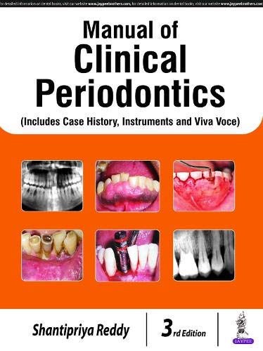 Essentials of Clinical Periodontology and Periodontics with Supplementary Manual of Clinical Periodontics (with Interactive DVD-ROM)