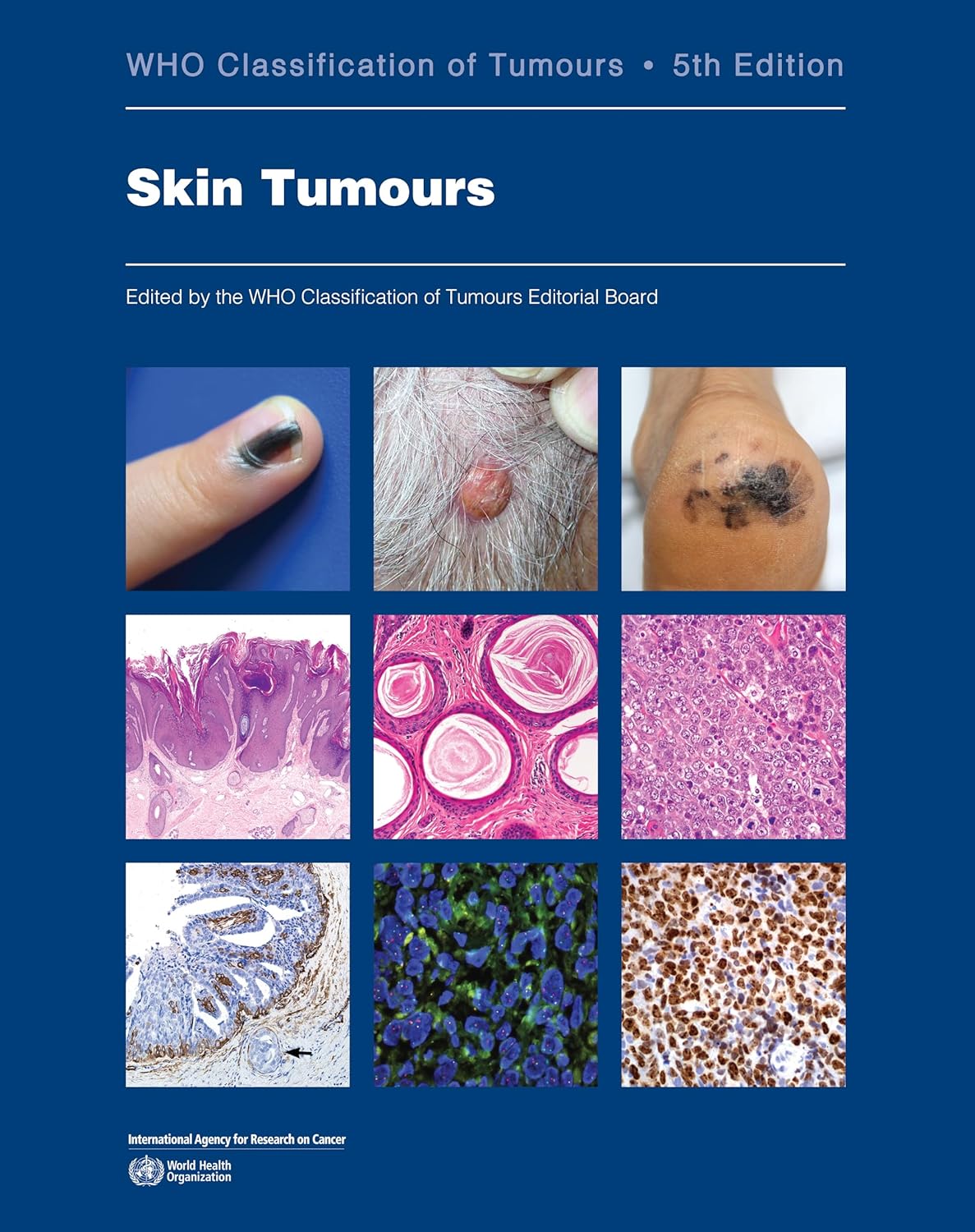 Skin Tumours: WHO Classification of Tumours, 5th Edition